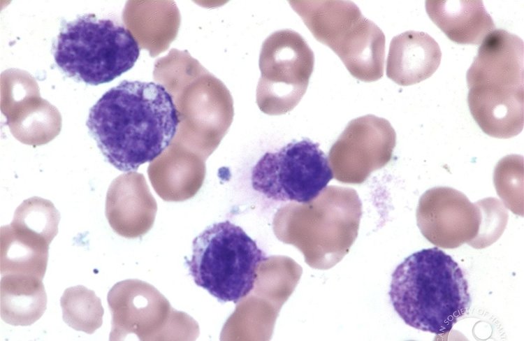 Mast+cells.jpeg
