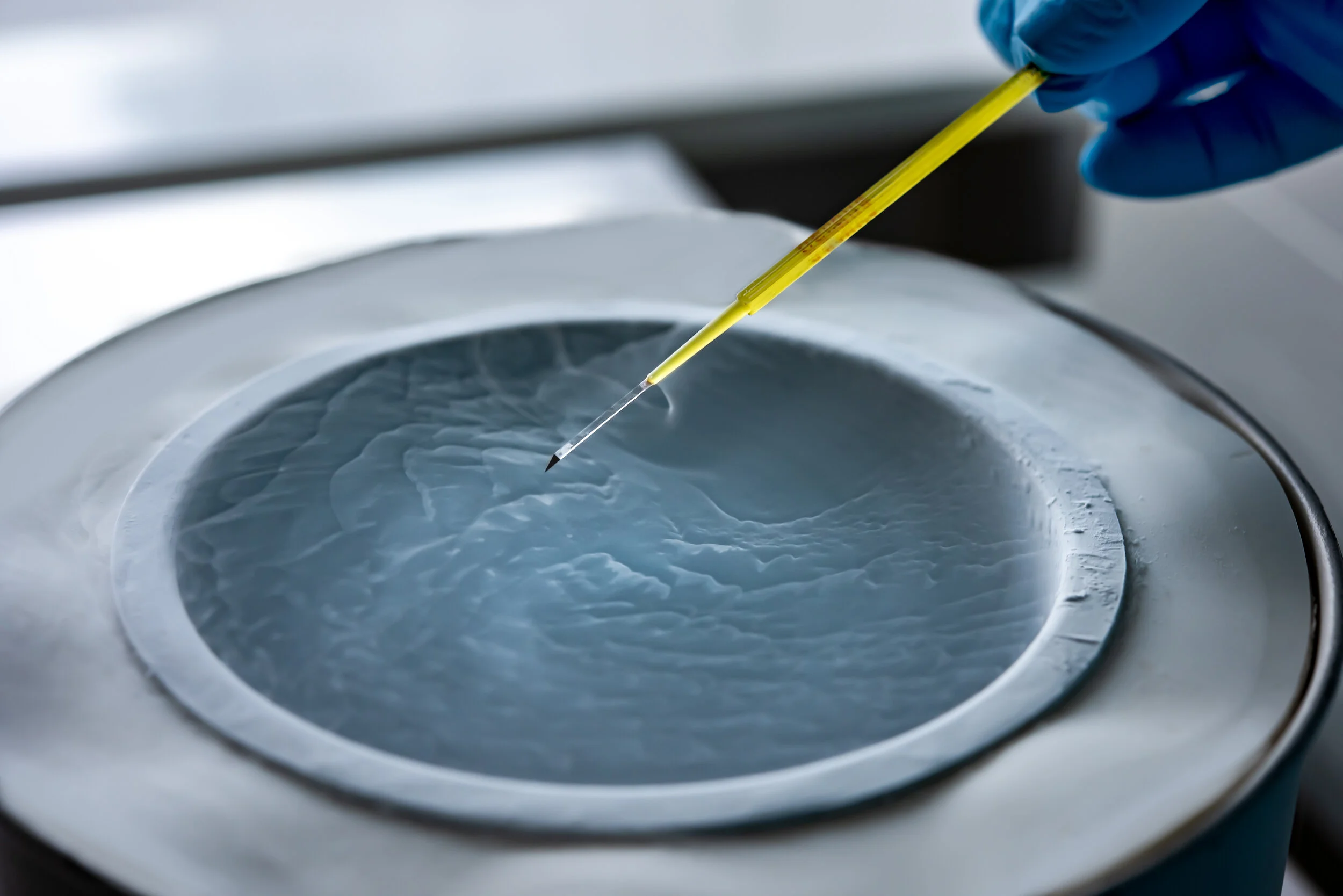 oocyte vitrification.jpg