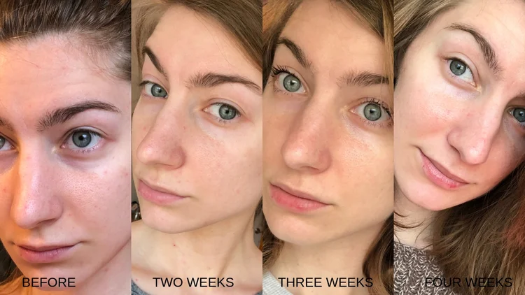Overlooked_and_Underrated_Beauty_Products_-_Openletr_Samantha_before_and_after.jpg