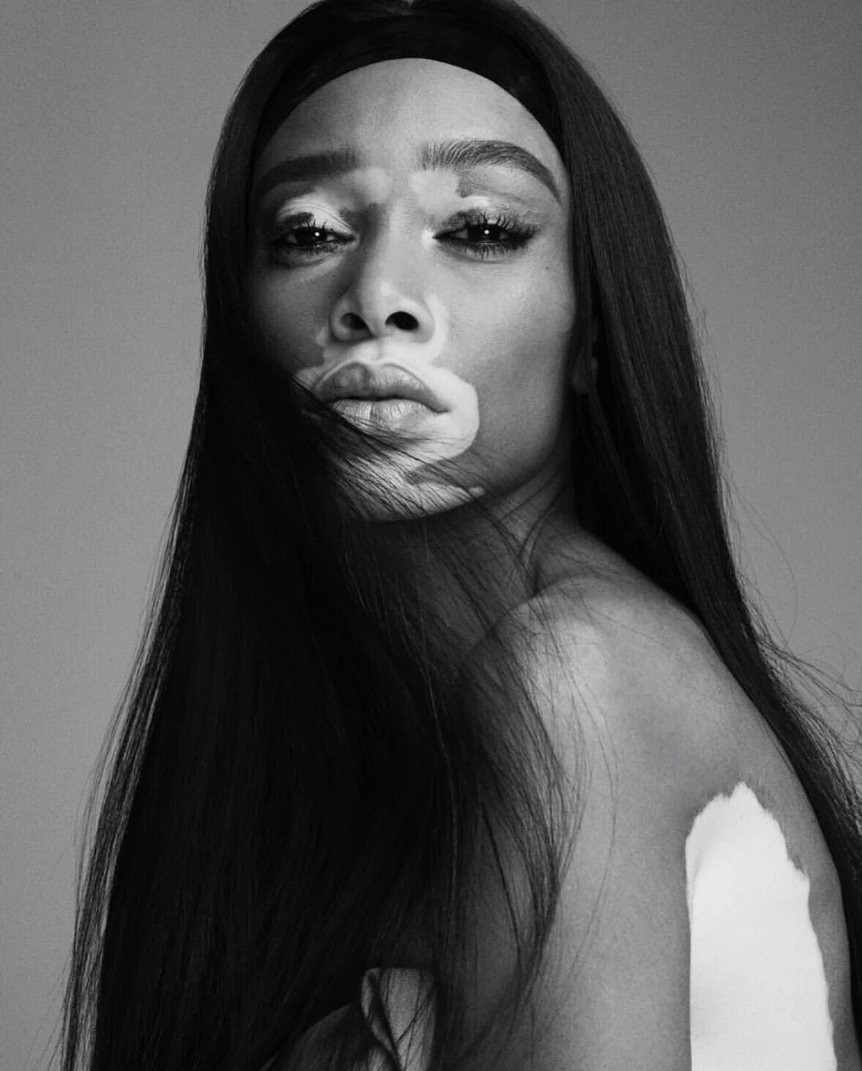 PHOTO: Winnie Harlow / Instagram