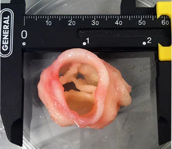 Bioprinted cardiac valve Image: Jonathan T. Butcher, Cornell University