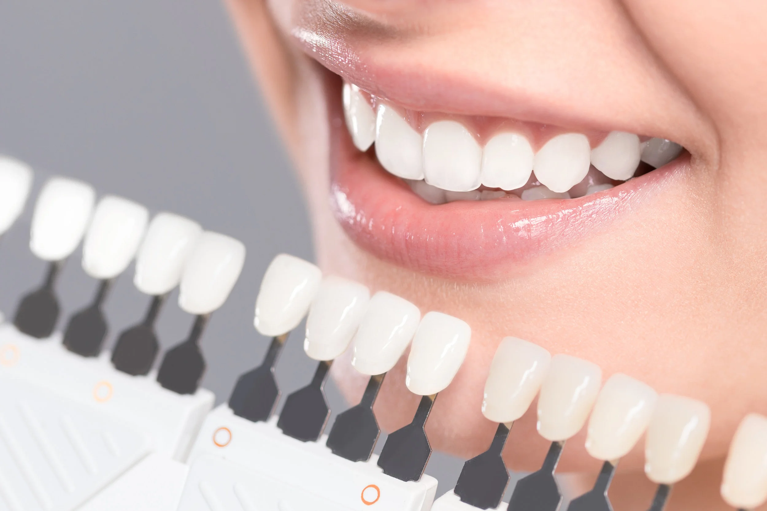 Teeth-Whitening1.jpg