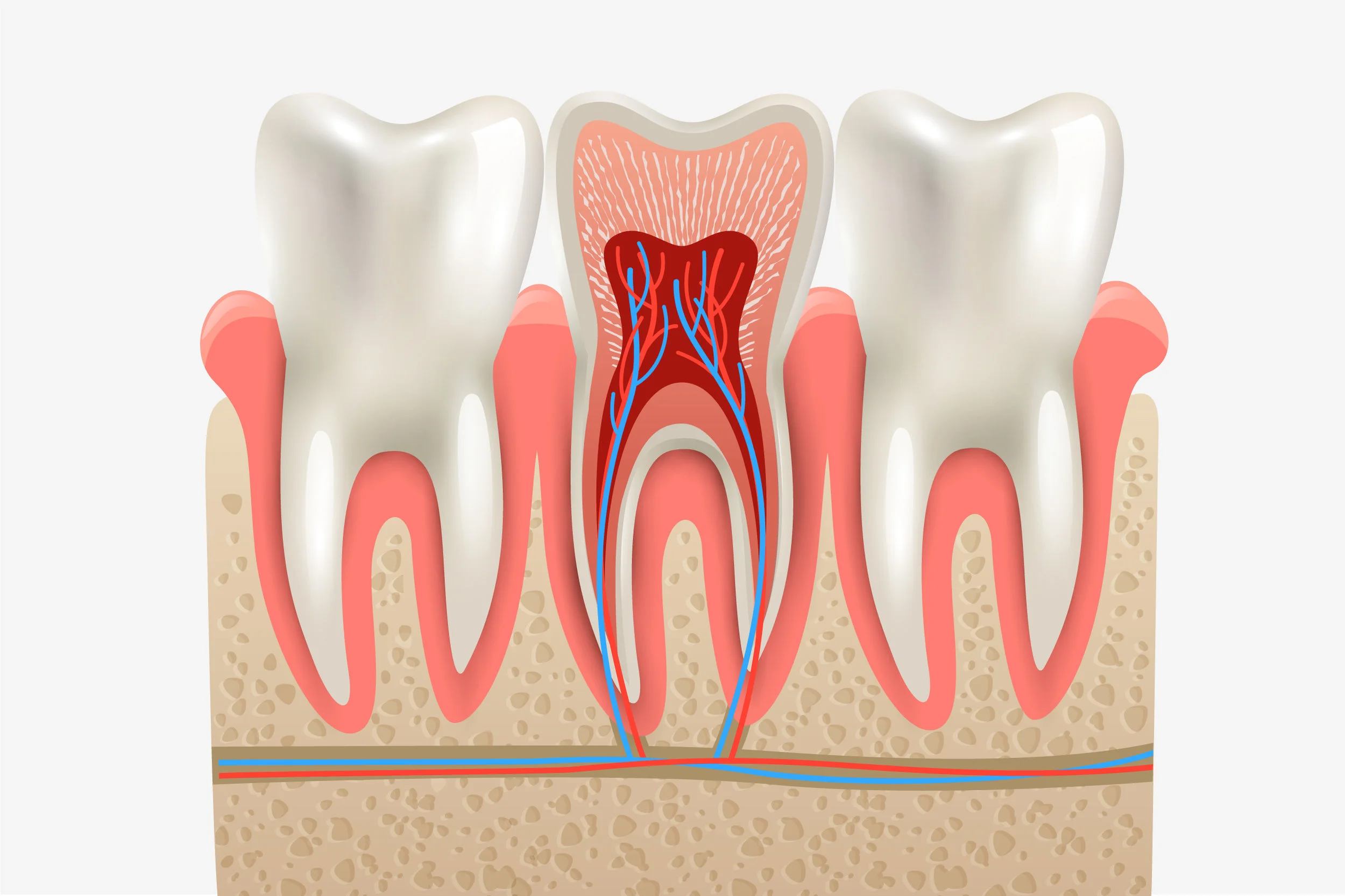 Root Canal