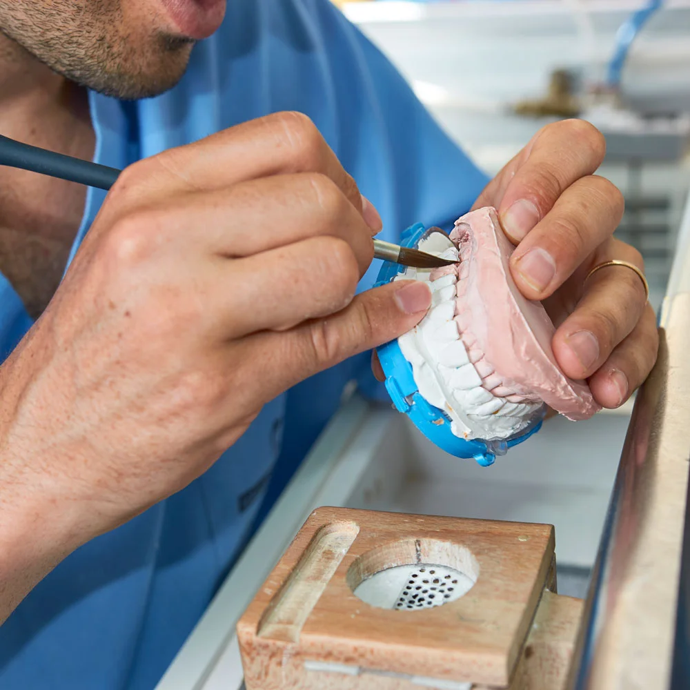 Different types of dental bridges