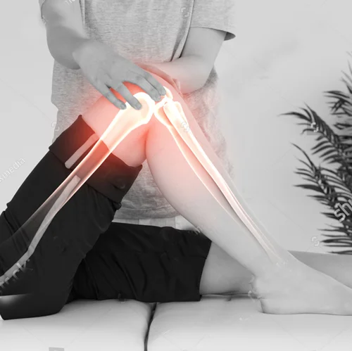 stock-photo-digital-composite-of-highlighted-bones-of-woman-at-physiotherapist-270883145-500.jpg