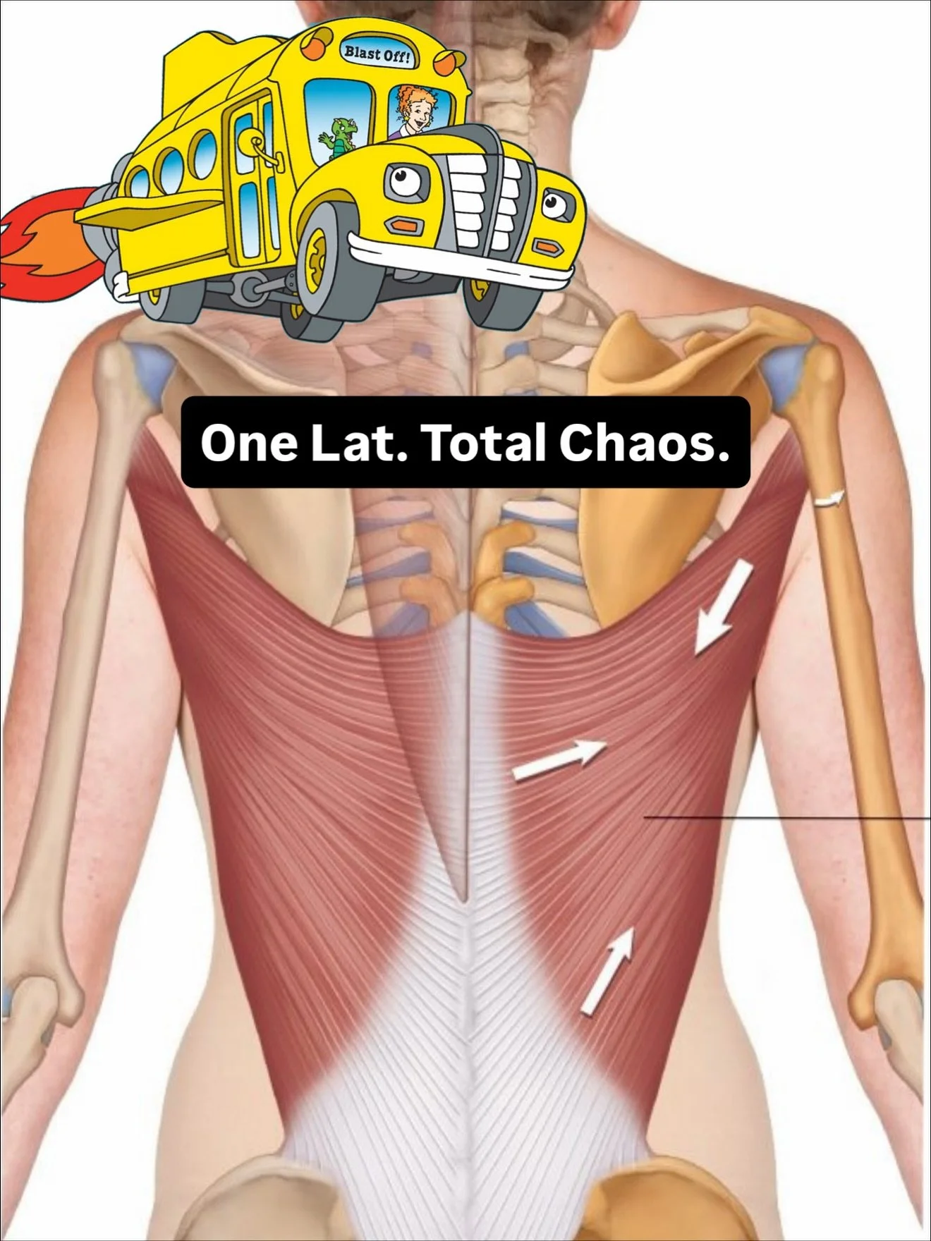 Seatbelts on, class. Dr. Sina is driving the Magic School Bus through the latissimus dorsi.

First stop, the back wall of the torso. The lat springs off T7 to T12, thoracolumbar fascia, iliac crest, and lower ribs, sometimes the scapular inferior ang