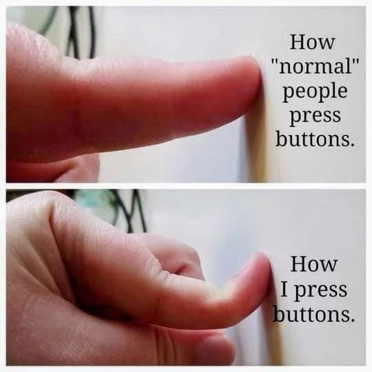 That thumb bend is not a party trick. It is connective tissue doing what it was built to do, and in hEDS it can mean every small task costs extra stability. Hypermobility is not just &ldquo;loose joints.&rdquo; Joints move differently, and the missin