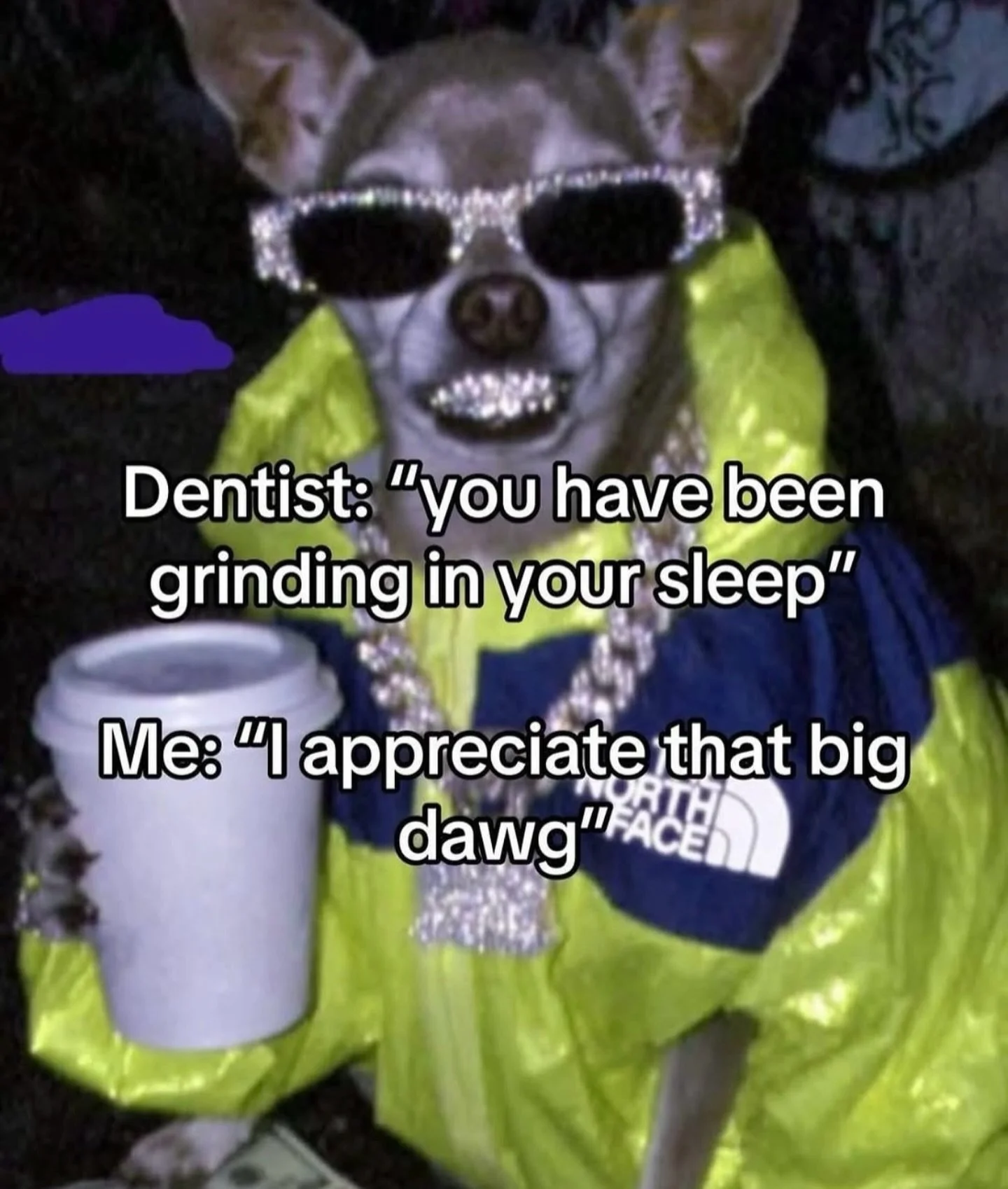 Your dentist is often the first one to see the signs in your mouth:
flattened teeth,
worn enamel,
small chips or fractures,
sensitivity,
and a jaw that has clearly been working overtime.

What a lot of people miss is this:
clenching and grinding are 