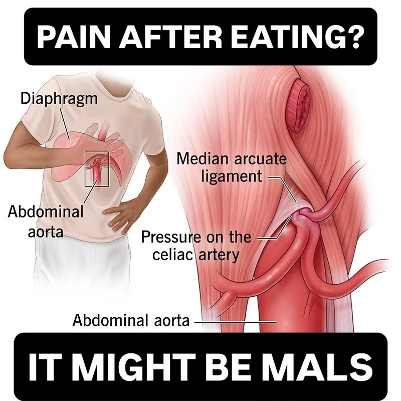 Ever skipped a meal because you knew it would hurt, then got told &ldquo;everything looks normal&rdquo;? That disconnect is real. Sometimes it&rsquo;s MALS.

MALS (Median Arcuate Ligament Syndrome) is a neurovascular compression. The median arcuate l