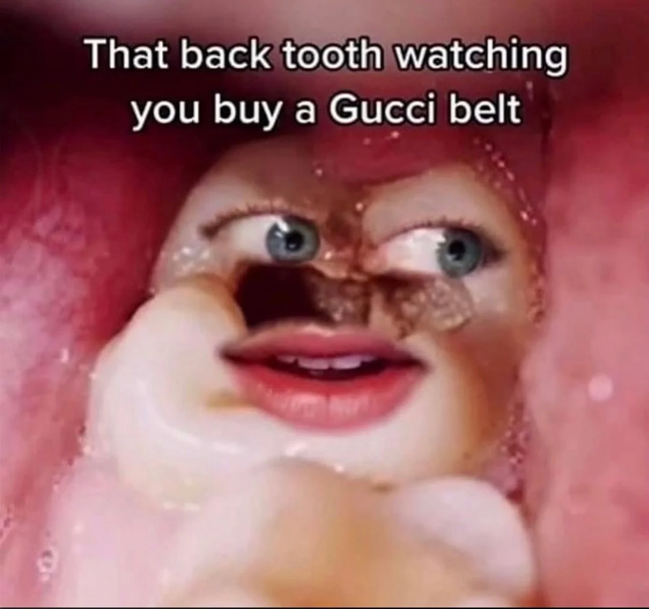 That back molar asked for help, got ignored, and then proceeded to fuck up the whole system. 🦷👀

A tiny chip/wear pattern on a back RIGHT molar changed her bite just enough.

No dramatic toothache.
No &ldquo;I broke my tooth&rdquo; moment.
Just one