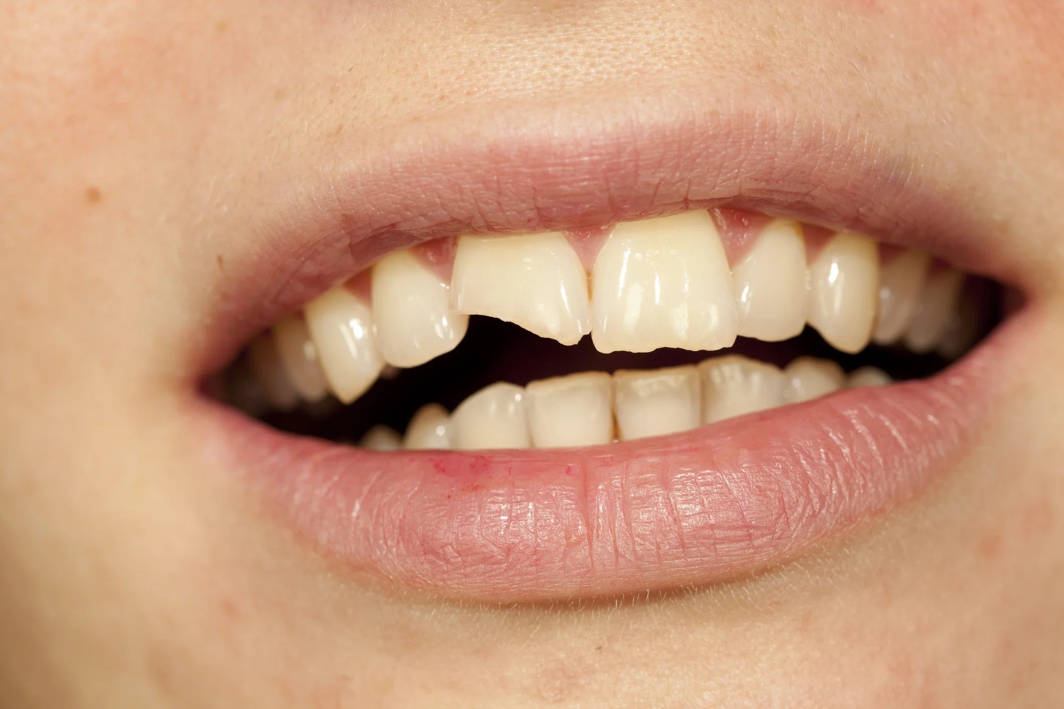 Photo by dabjola/iStock / Getty Images