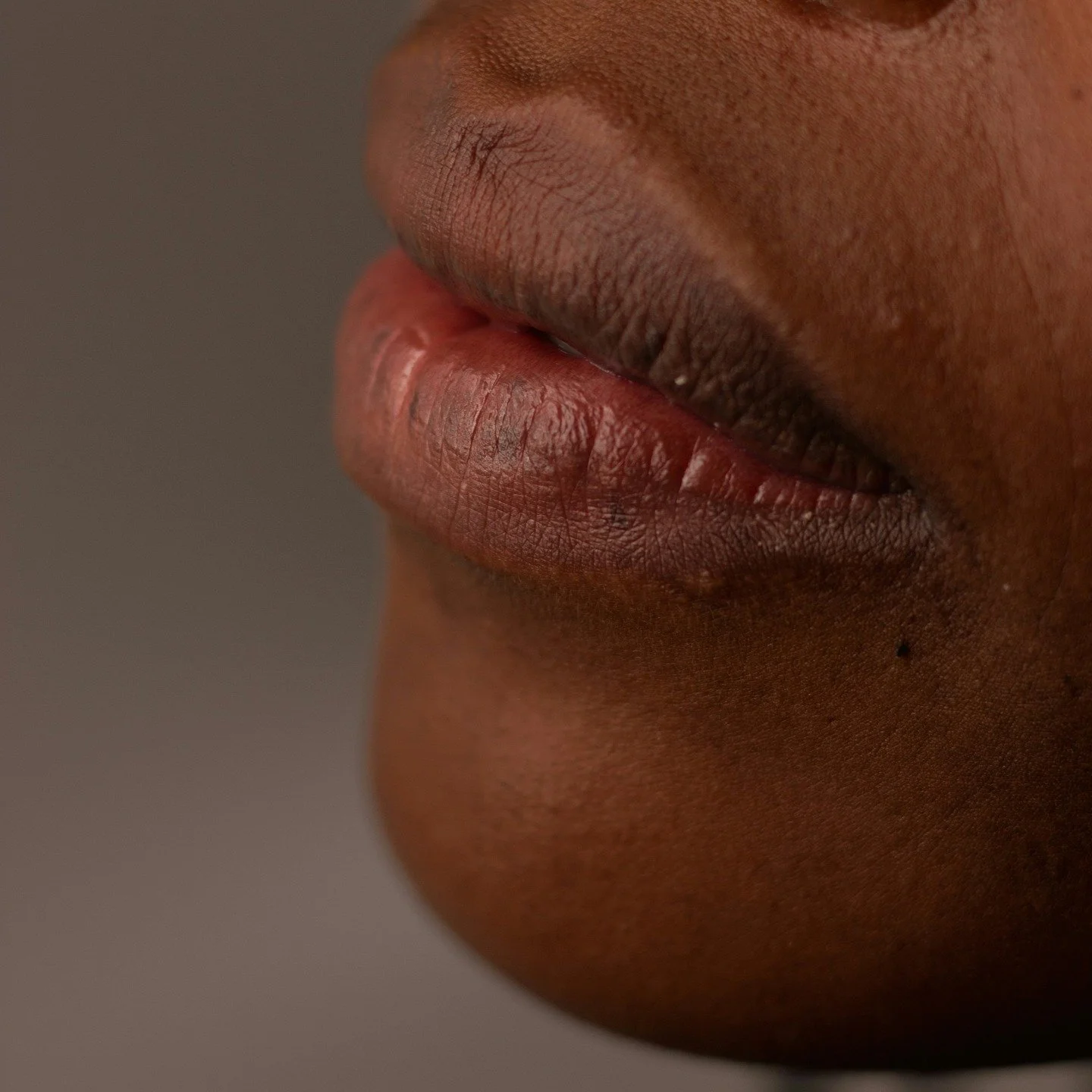 Epilfree : une &eacute;pilation s&ucirc;re pour les peaux fonc&eacute;es 💛🤎
Si le laser n&rsquo;est pas pour vous &agrave; cause du risque de taches, Epilfree est une alternative qui fonctionne tr&egrave;s bien.
C&rsquo;est un syst&egrave;me sans l