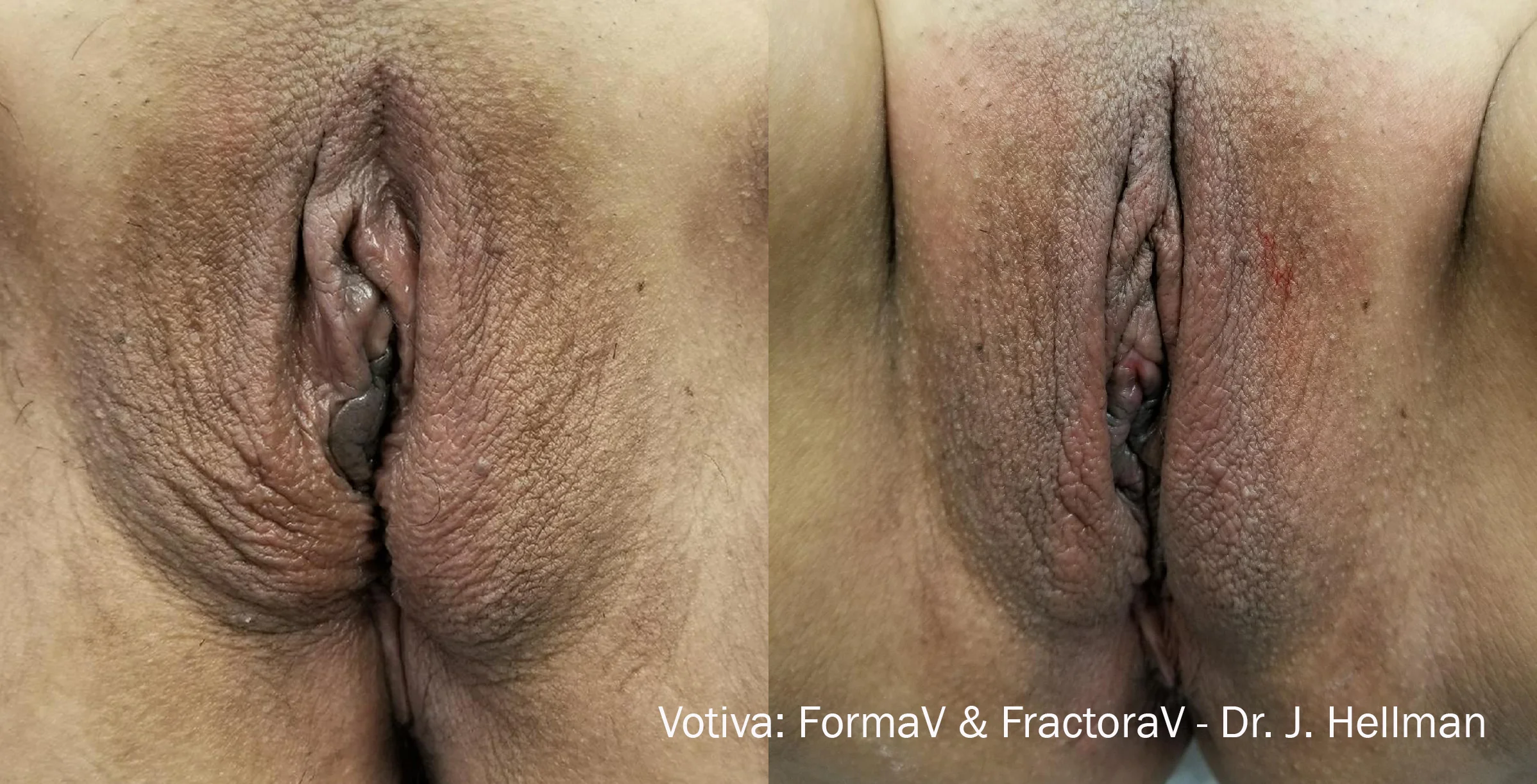 Votiva Website_1.jpg