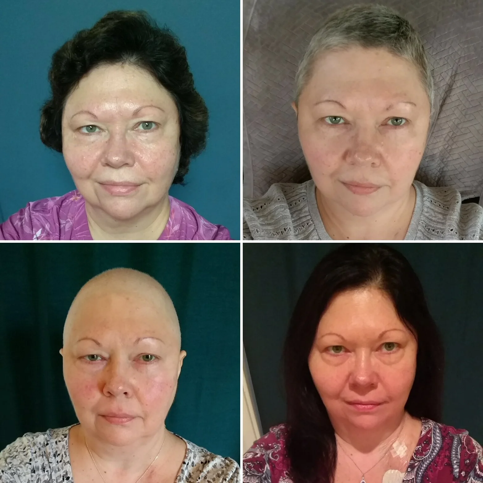 Tracy Oldfather _before, during, immediately after, present day.jpg