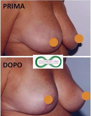MASTOPESSI 1.jpg