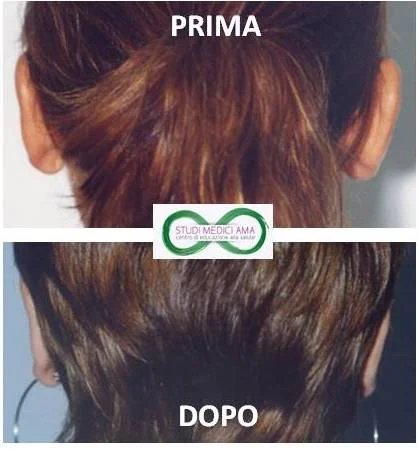 OTOPLASTICA 1.jpg