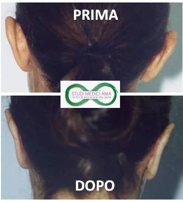 OTOPLASTICA 2.jpg
