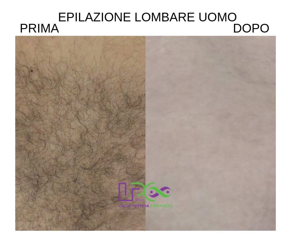EPILAZIONE LOMBARE UOMO .png