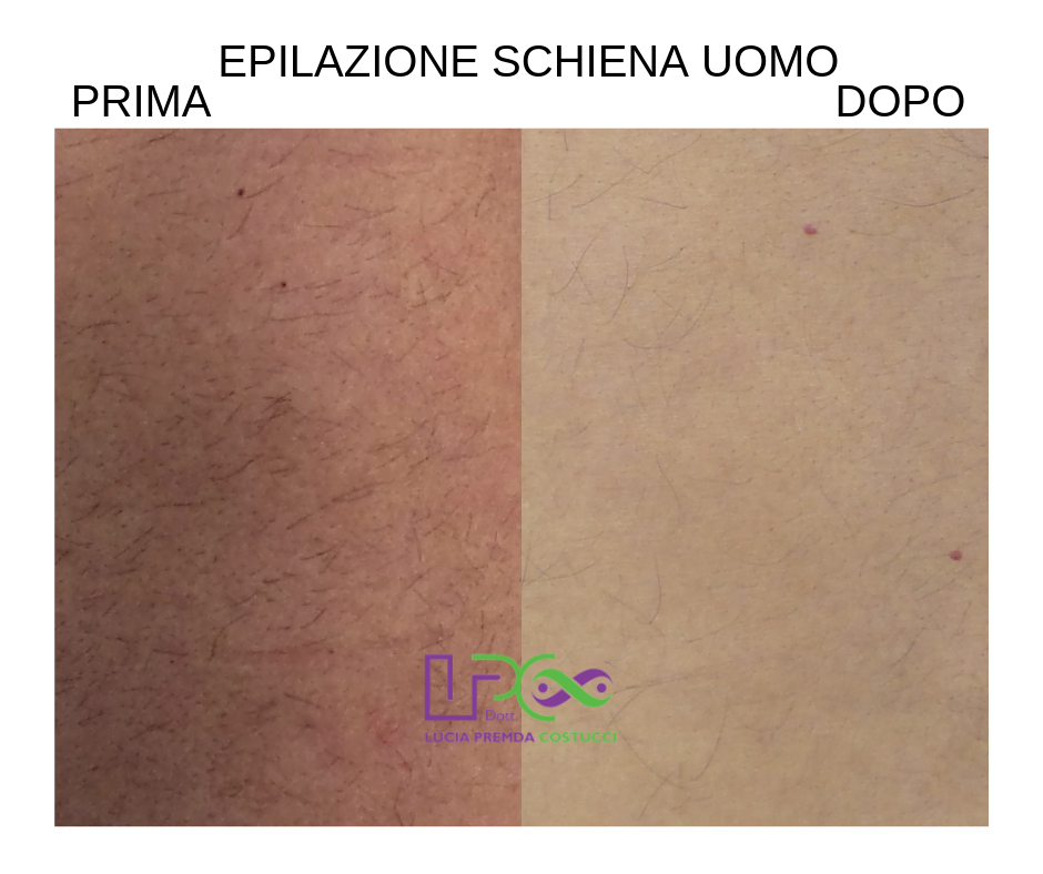 EPILAZIONE SCHIENA UOMO .png