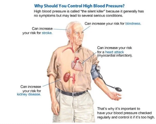 controlling BP.jpeg