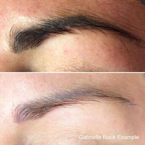 Brows by Beatrice — Perth Saline Tattoo Removal