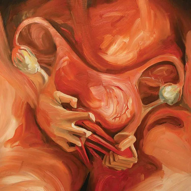 Endometriosis: Beyond the Trend, Into the True Struggle