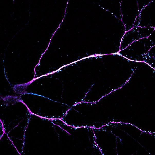 Mouse hippocampal neurons, 21 DIV