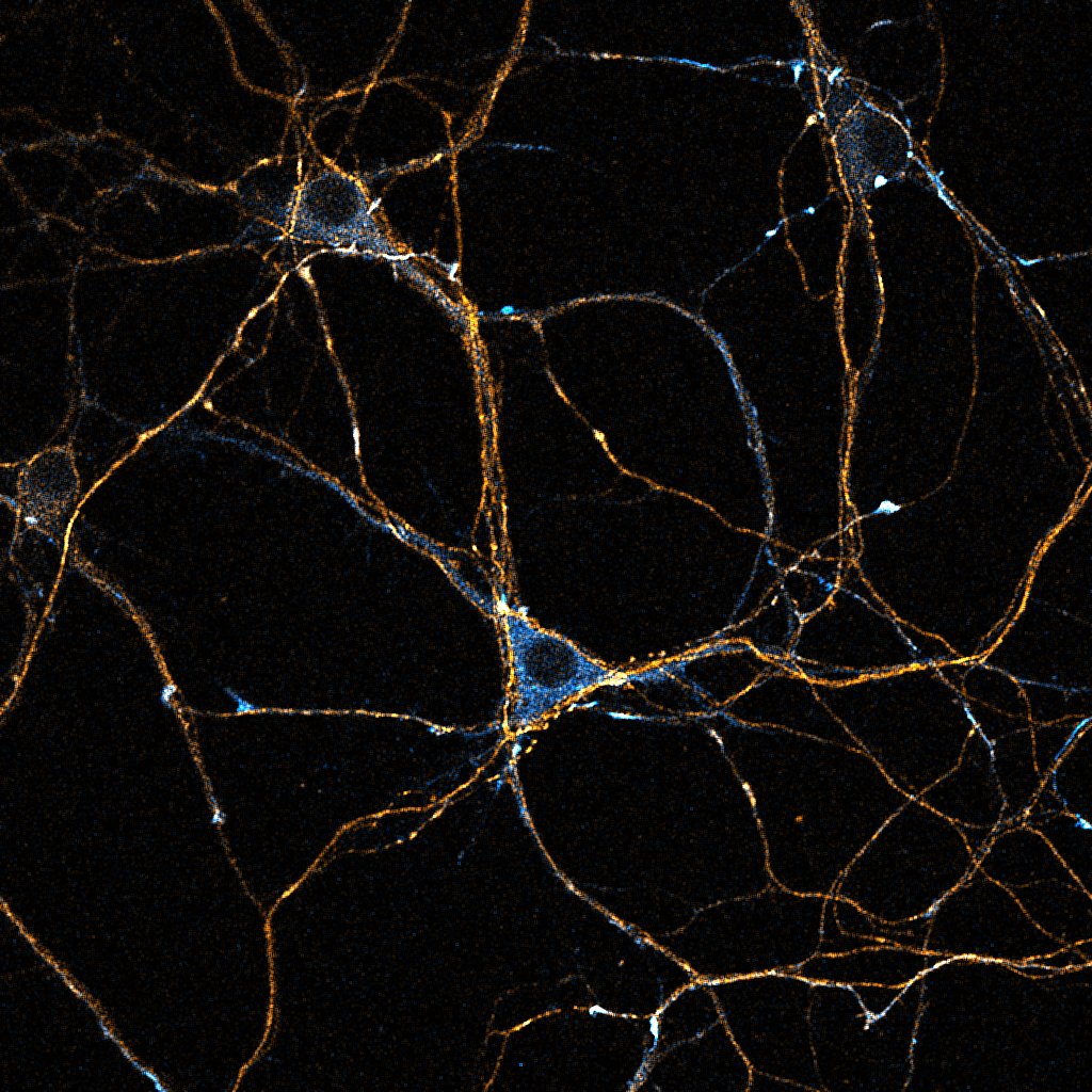 Mouse hippocampal neurons, 8 DIV