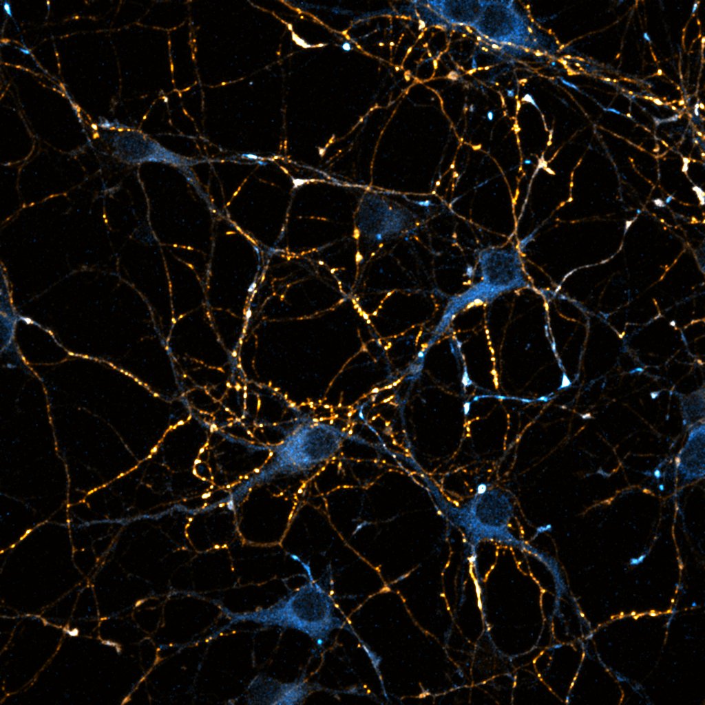 Mouse hippocampal neurons, 8 DIV