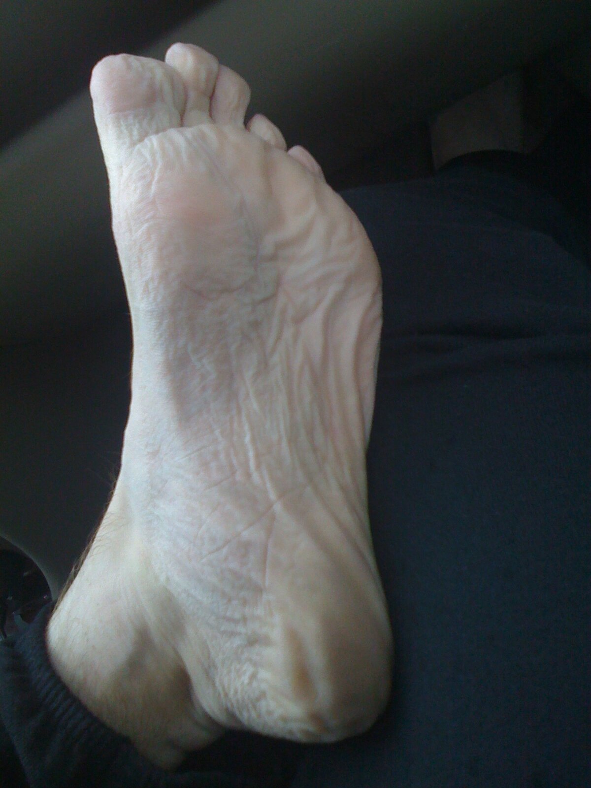  My poor foot after the race. It was pure heaven putting on clean, dry white socks, just heaven. 