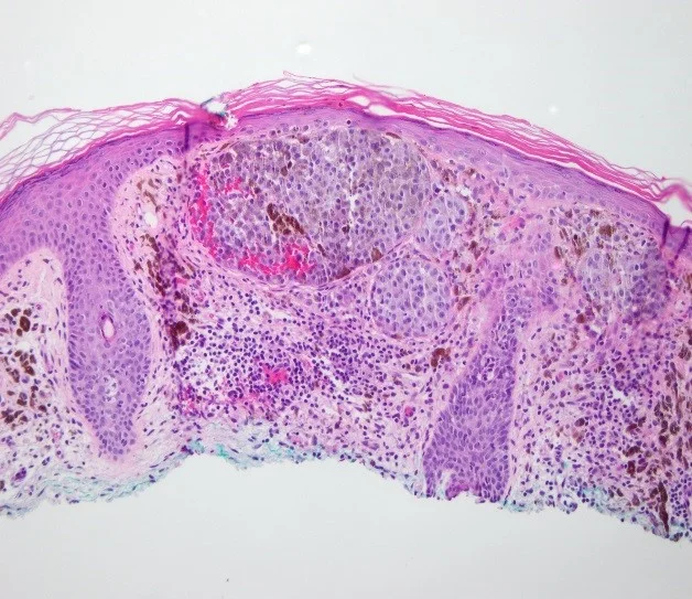 Case1_2.jpg