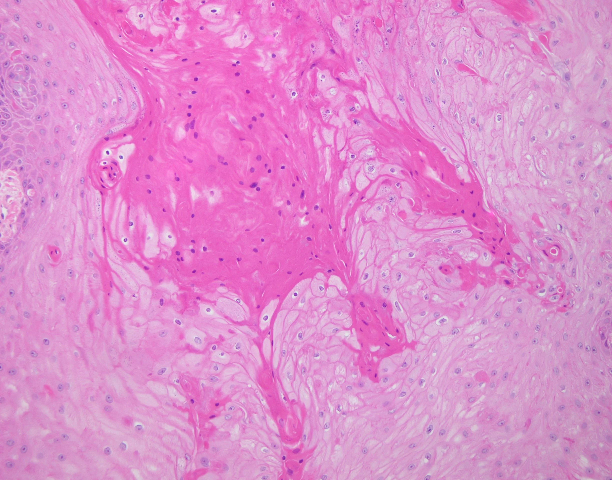 Case4_4.jpg