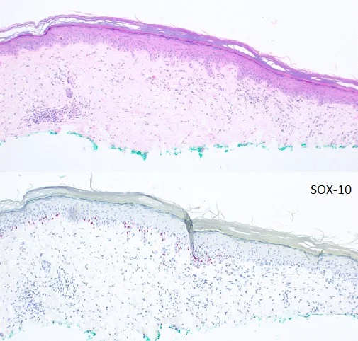 Case6a_2.jpg
