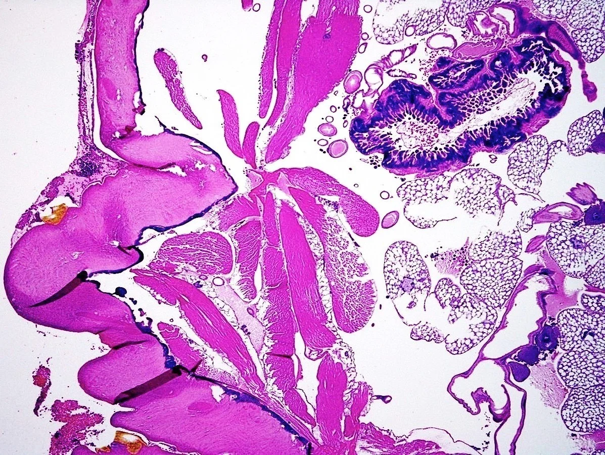 Case2_2.jpg