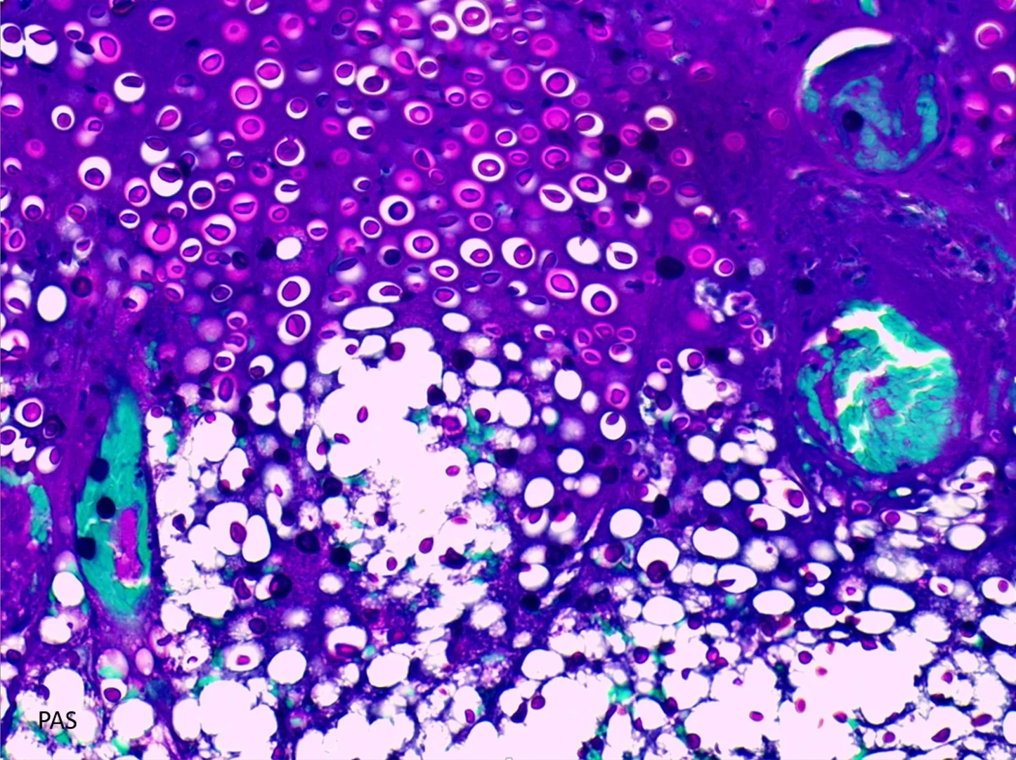 Case4_5.jpg