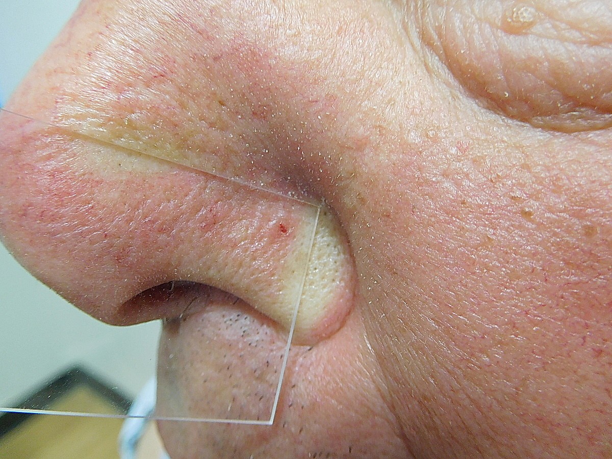 Case8_2.jpg