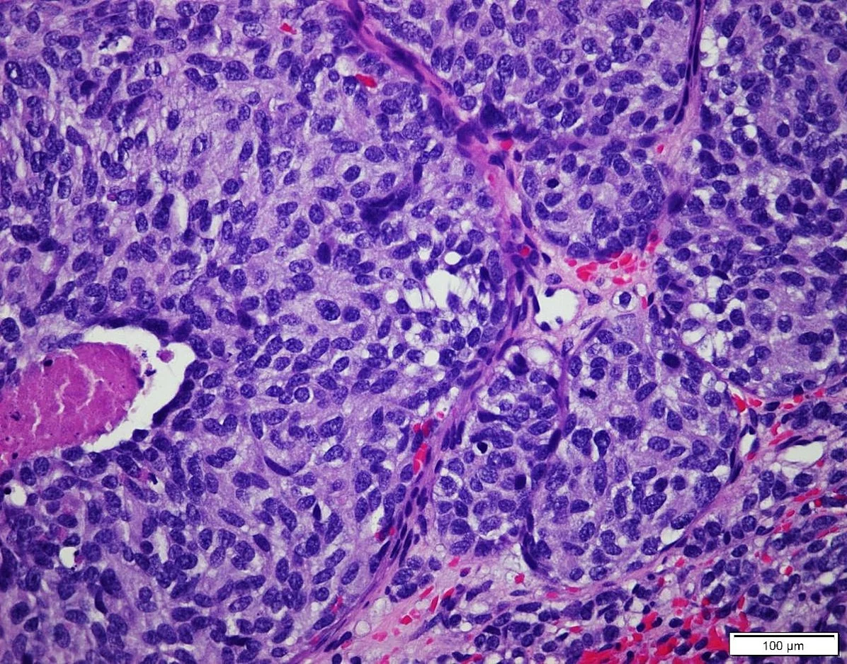Case9_3.jpg