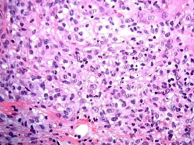 Case10a_5.jpg