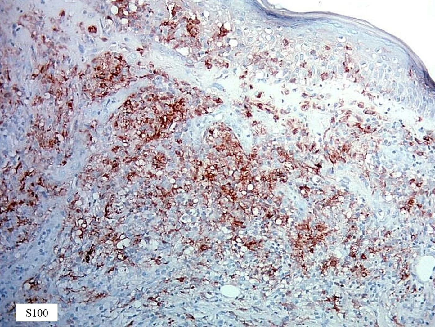 Case10a_6.jpg