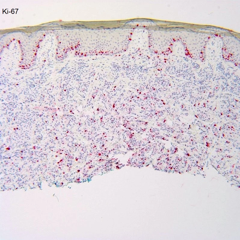 Case11_7.jpg