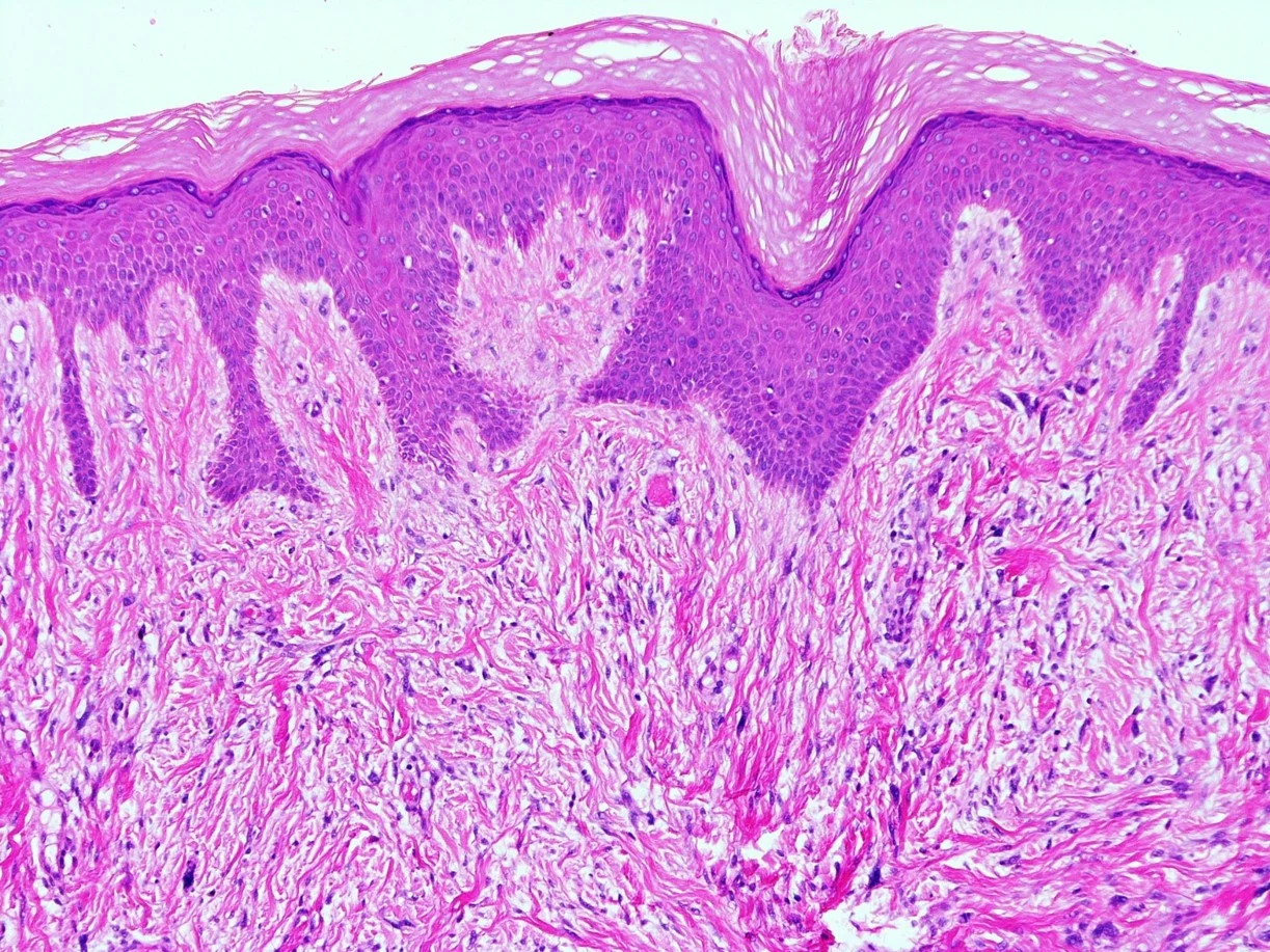 Case13_2.jpg