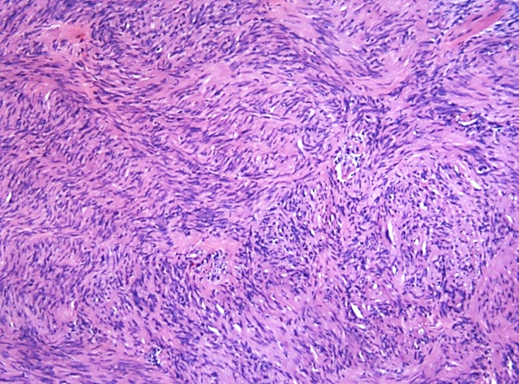 Case14_3.jpg