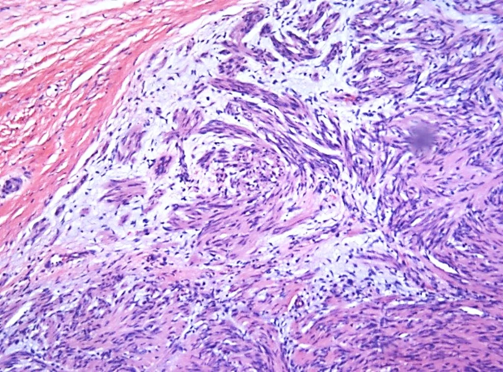 Case14_5.jpg