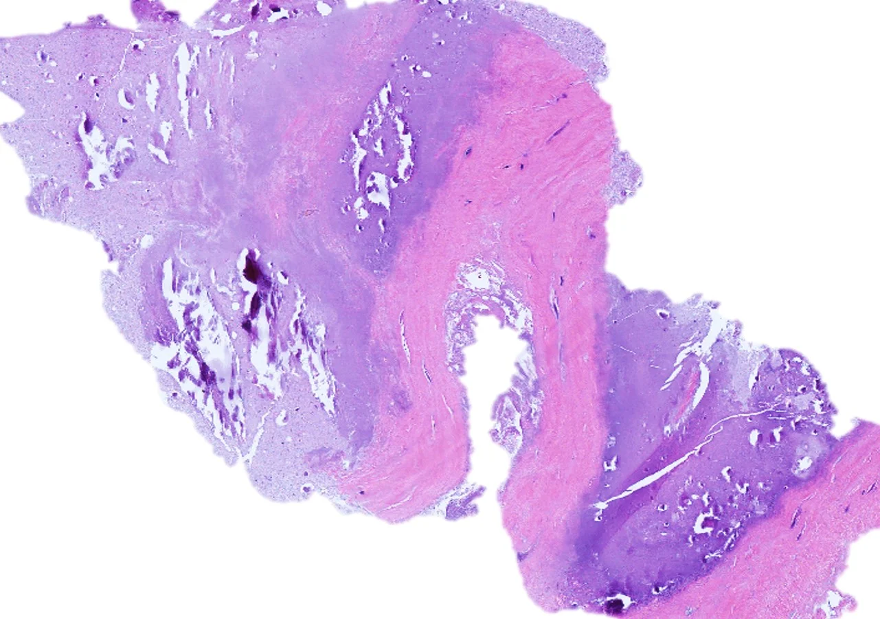 Case16_4.jpg