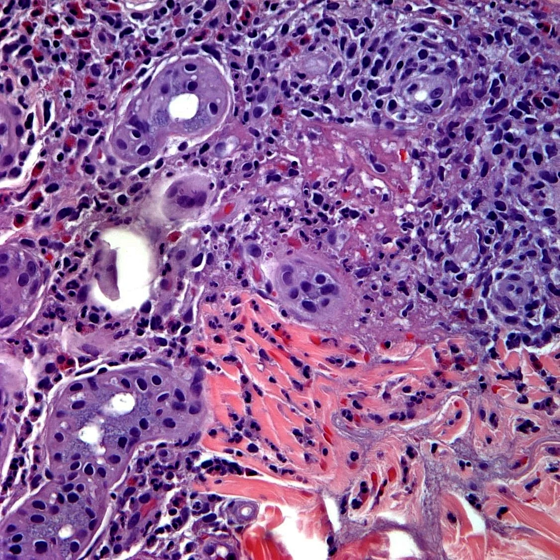 Case23_4.jpg