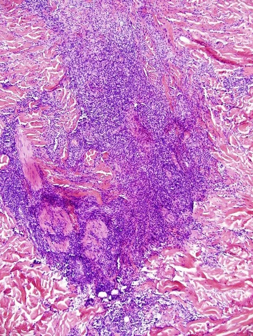 Case25_6.jpg