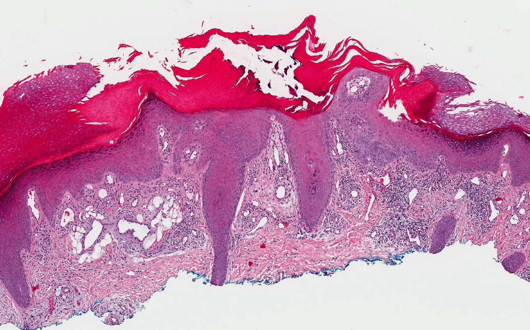 Case29_4.jpg