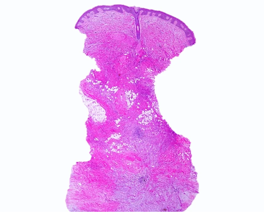Case32_4.jpg