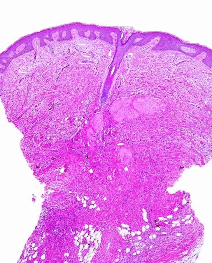 Case32_5.jpg