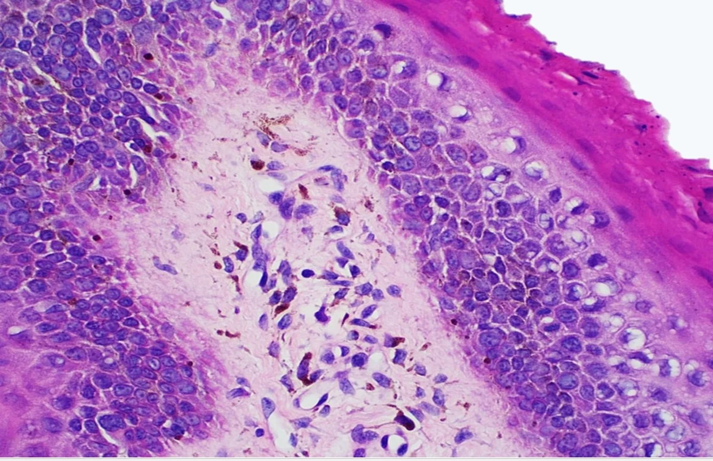 Case18_6.jpg